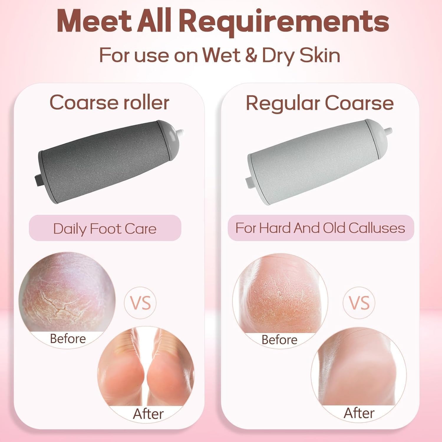 Callus Remover for Smooth Feet | Dead Skin Remover - Image 7